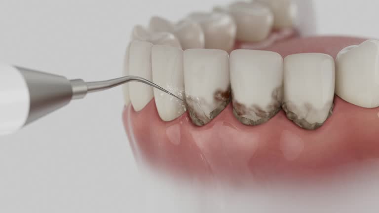 Reliable Dental Implants contractor in Timonium, MD by Smile Center Dentistry